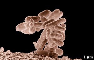 E Coli Outbreak Kills 1, Sickens Dozens via Organic Carrots Bunch of fresh organic carrots with a warning label overlay symbolizing bacterial contamination risk